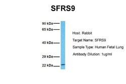 SFRS9 Antibody, Novus Biologicals 0.05mg; Unlabeled:Antibodies, Polyclonal