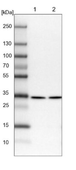 SFXN1 Antibody, Novus Biologicals 0.1mL; Unlabeled:Antibodies, Polyclonal