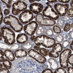 SFXN2 Antibody, Novus Biologicals 0.1mL; Unlabeled:Antibodies, Polyclonal