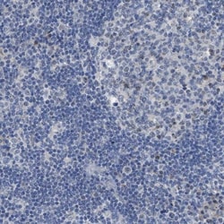 SFXN2 Antibody, Novus Biologicals 0.1mL; Unlabeled:Antibodies, Polyclonal
