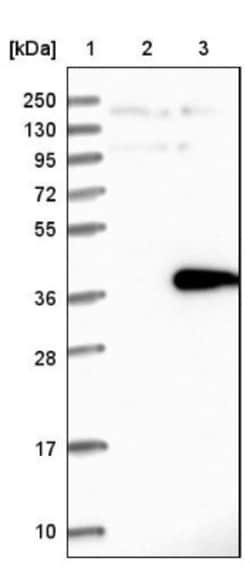 SFXN2 Antibody, Novus Biologicals 0.1mL; Unlabeled:Antibodies, Polyclonal