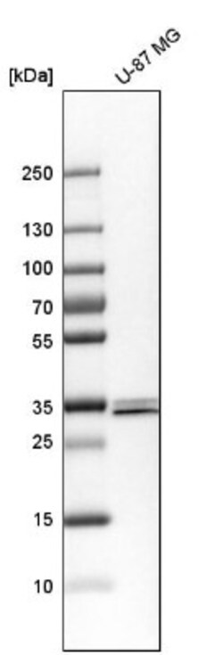 SFXN3 Antibody, Novus Biologicals 25 &mu;L | Buy Online | Novus Biologicals | Fisher Scientific
