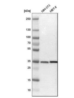 SFXN3 Antibody, Novus Biologicals 25 &mu;L | Buy Online | Novus Biologicals | Fisher Scientific