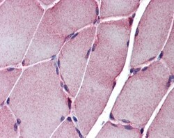 epsilon-Sarcoglycan Antibody, Novus Biologicals:Antibodies:Primary Antibodies