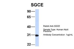 epsilon-Sarcoglycan Antibody, Novus Biologicals:Antibodies:Primary Antibodies