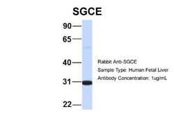 epsilon-Sarcoglycan Antibody, Novus Biologicals:Antibodies:Primary Antibodies