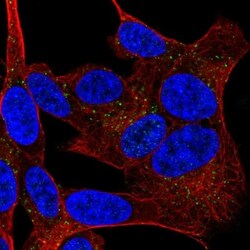 SGLT1/SLC5A1 Antibody, Novus Biologicals 0.1mL; Unlabeled:Antibodies, Polyclonal