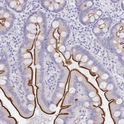 SGLT1/SLC5A1 Antibody, Novus Biologicals 0.1mL; Unlabeled:Antibodies, Polyclonal