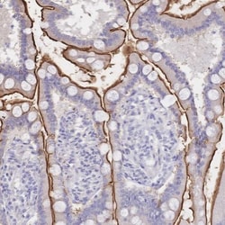 SGLT1/SLC5A1 Antibody, Novus Biologicals 25 &mu;L, Unlabeled:Antibodies,