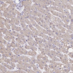 SGLT1/SLC5A1 Antibody, Novus Biologicals 25 &mu;L, Unlabeled:Antibodies,