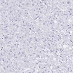 SGLT1/SLC5A1 Antibody, Novus Biologicals 0.1mL; Unlabeled:Antibodies, Polyclonal