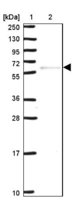SGLT1/SLC5A1 Antibody, Novus Biologicals 25 &mu;L, Unlabeled:Antibodies,