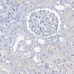 SGOL2 Antibody, Novus Biologicals 0.1mL; Unlabeled:Antibodies, Polyclonal