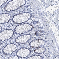 SGOL2 Antibody, Novus Biologicals 0.1mL; Unlabeled:Antibodies, Polyclonal