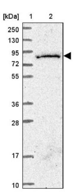 SGSM3 Antibody, Novus Biologicals 25ul | Buy Online | Novus Biologicals | Fisher Scientific
