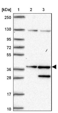 SGTA Antibody, Novus Biologicals 25 &mu;L; Unlabeled:Antibodies, Polyclonal