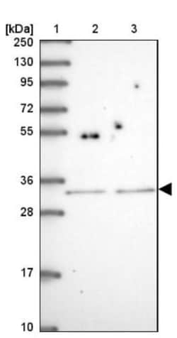 SH2B2 Antibody, Novus Biologicals 0.1mL; Unlabeled:Antibodies, Polyclonal