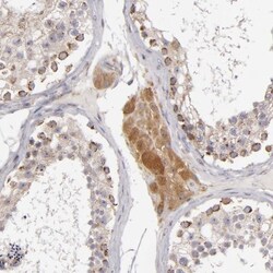 SH2D4A Antibody, Novus Biologicals:Antibodies:Primary Antibodies