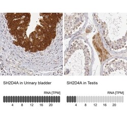 SH2D4A Antibody, Novus Biologicals:Antibodies:Primary Antibodies