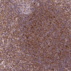 SH3BGRL Antibody, Novus Biologicals:Antibodies:Primary Antibodies