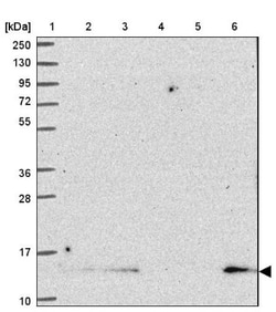 SH3BGRL Antibody, Novus Biologicals:Antibodies:Primary Antibodies