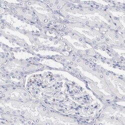 SH3BP1 Antibody, Novus Biologicals:Antibodies:Primary Antibodies