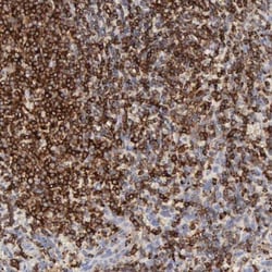 SH3BP1 Antibody, Novus Biologicals:Antibodies:Primary Antibodies