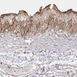 SH3BP2 Antibody, Novus Biologicals 0.1mL; Unlabeled:Antibodies, Polyclonal