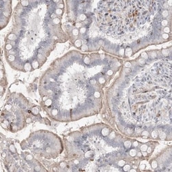 SH3BP4 Antibody, Novus Biologicals 25 &mu;L, Unlabeled:Antibodies, Polyclonal