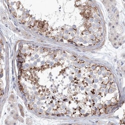 SH3BP5 Antibody, Novus Biologicals 25 &mu;L; Unlabeled:Antibodies, Polyclonal