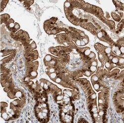 SH3D19 Antibody, Novus Biologicals 25 &mu;L; Unlabeled:Antibodies, Polyclonal