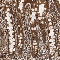 SH3GLB2 Antibody, Novus Biologicals 0.1mL; Unlabeled:Antibodies, Polyclonal