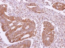 SH3GLB2 Antibody, Novus Biologicals 0.1mL; Unlabeled:Antibodies, Polyclonal