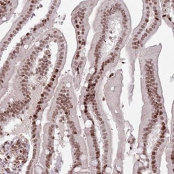 SH3MD4 Antibody, Novus Biologicals:Antibodies:Primary Antibodies