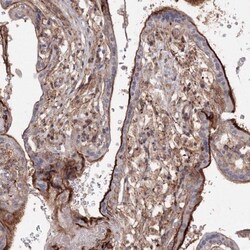 SH3PXD2A Antibody, Novus Biologicals 0.1mL; Unlabeled:Antibodies, Polyclonal