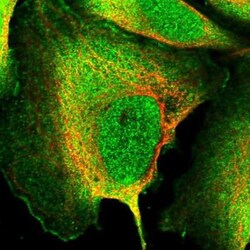 SH3PXD2B Antibody, Novus Biologicals:Antibodies:Primary Antibodies