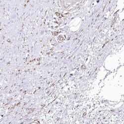 SH3PXD2B Antibody, Novus Biologicals:Antibodies:Primary Antibodies