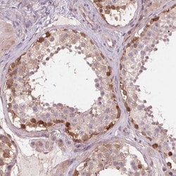 SH3RF2 Antibody, Novus Biologicals:Antibodies:Primary Antibodies