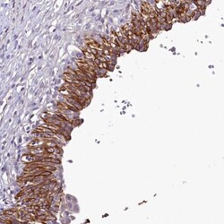 SH3TC2 Antibody, Novus Biologicals 25 &mu;L, Unlabeled:Antibodies, Polyclonal