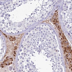 SH3TC2 Antibody, Novus Biologicals:Antibodies:Primary Antibodies