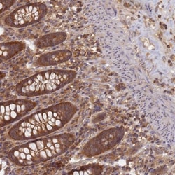 SHARPIN Antibody, Novus Biologicals 0.1mL; Unlabeled:Antibodies, Polyclonal