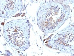 SHBG Antibody (SHBG/245), Novus Biologicals 0.2mg; Unlabeled:Antibodies,