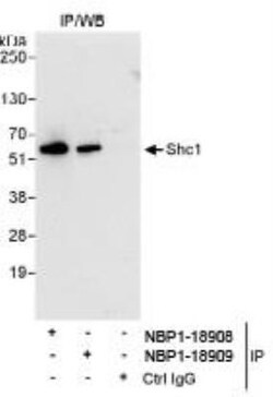 SHC1 Antibody, Novus Biologicals 0.1mL; Unlabeled:Antibodies, Polyclonal