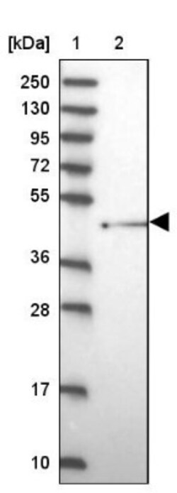 SHFM3 Antibody, Novus Biologicals 0.1mL; Unlabeled:Antibodies, Polyclonal