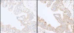 SHIP2/INPPL1 Antibody, Novus Biologicals 0.1mg; Unlabeled:Antibodies, Polyclonal