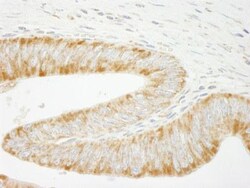 SHIP2/INPPL1 Antibody, Novus Biologicals 0.1mg; Unlabeled:Antibodies, Polyclonal