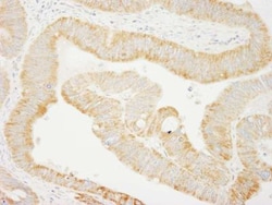 SHIP2/INPPL1 Antibody, Novus Biologicals 0.1mg; Unlabeled:Antibodies, Polyclonal