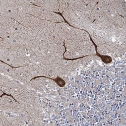 SHIP2/INPPL1 Antibody, Novus Biologicals 0.1mL; Unlabeled:Antibodies, Polyclonal