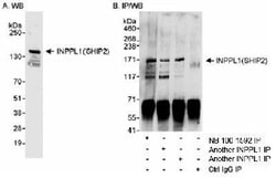SHIP2/INPPL1 Antibody, Novus Biologicals 0.1mg; Unlabeled:Antibodies, Polyclonal