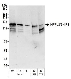 SHIP2/INPPL1 Antibody, Novus Biologicals 0.1mg; Unlabeled:Antibodies, Polyclonal